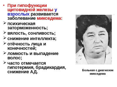 Комплексный подход к лечению претибиальной микседемы на основе  пульс-терапии преднизолоном и электронейромиостимуляции (FREMS-терапии) у  пациентки с болезнью Грейвса и эндокринной офтальмопатией | Перепелова |  Проблемы Эндокринологии