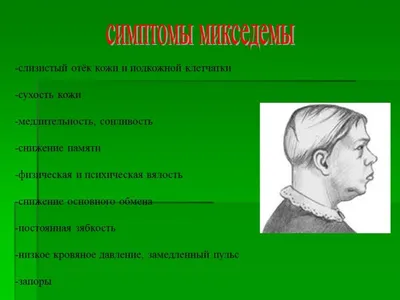 Эндокринные железы (железы внутренней секреции) 2-ая часть. Щитовидная  железа. | Издательство МЕРА | Дзен