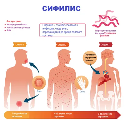 VITAL + - Микседема — эндокринное заболевание, которое возникает из-за  недостаточного выброса гормонов щитовидной железы. ⠀ ☝️Болезнь может дать о  себе знать в любом возрасте, но наиболее подвержены недугу женщины в период