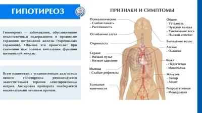 Заболевания щитовидной железы - презентация онлайн