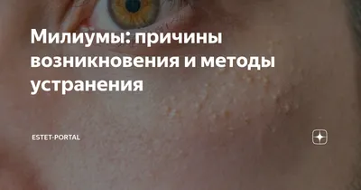 Милиумы на лице - причины и лечение, как убрать белые угри на лице