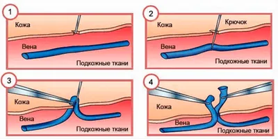 Результаты