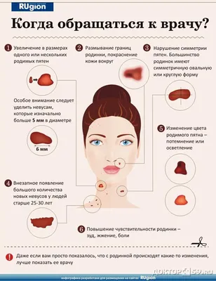 Меланома кожи - симптомы, диагностика и методы лечения | Daily Medical