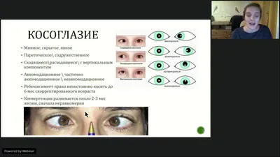 Косоглазие у детей — почему появляется и как лечится