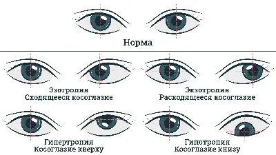 Детская поликлиника Здравинка в Ульяновске - Предоставление медицинских  услуг детям от 0 до 18 лет - Важно!