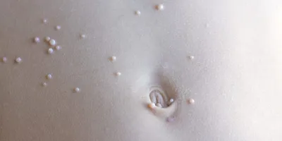 Моллюски паразиты на коже фото фото