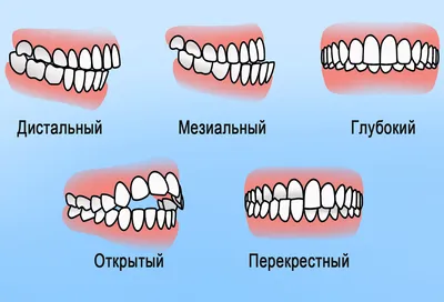 Есть ли корни у молочных зубов? | Пикабу