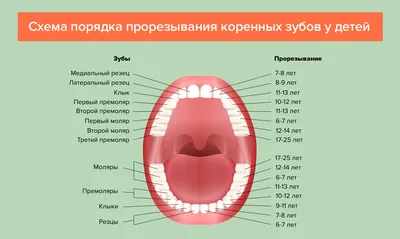 Удалить всегда успею»: как я поставила брекеты на молочные зубы в 25 лет