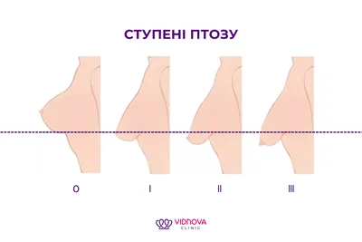 Грудная стенка и молочная железа : нормальная анатомия | e-Anatomy