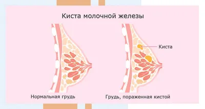 Ажиотаж по поводу фотографией того, как выглядят молочные железы женщин. |  Энциклопедия молодой мамы | Дзен