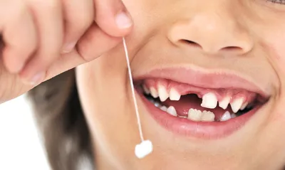 Молочные зубы у взрослых | Семейная стоматология