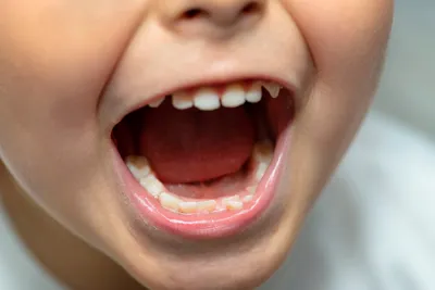 Молочные зубы — как растут и когда сменяются — Стоматология «Доктор  НеболитЪ»
