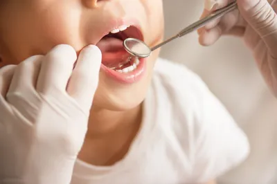Коронки на молочные зубы в Москве, цены на детские коронки в стоматологии  АО Медицина