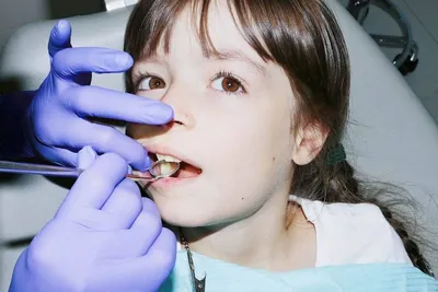 Нужно ли лечить молочные зубы у детей?