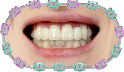 Нужно ли лечить молочные зубы - отвечают стоматологи
