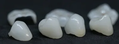 Молочные зубы можно не лечить - Мифы стоматологии - Клиника Doctor