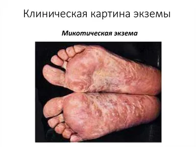 Внутренние болезни : Болезни кожи. Диагностика и лечение