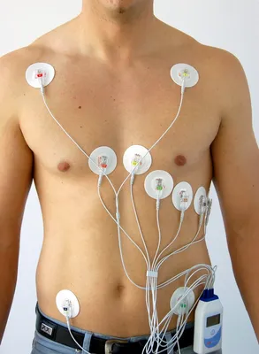 Холтер или суточное мониторирование ЭКГ в Днепре - записаться на приём и  цены - МедЭксперт