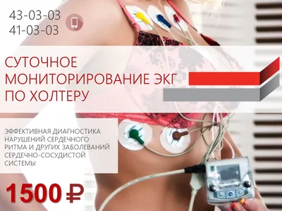 Холтер (мониторинг сердца) - описание процедуры и показания | KPIZ.ru