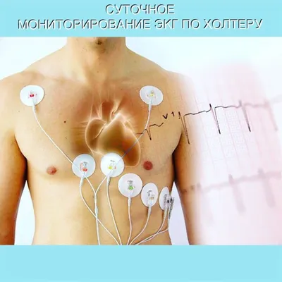 Суточный мониторинг сердца в СПб | Доктор САН