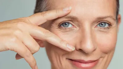 Гусиные лапки вокруг глаз – лечение в медцентре «Номосклиник» | Стоимость  процедуры в Москве, отзывы, вопросы и ответы