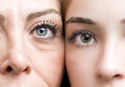 Как ухаживать за кожей вокруг глаз в 25, 35 и 40 лет и что такое  блефаропластика | РБК Стиль