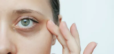 Как убрать морщины под глазами [дома или в салоне] — обзор средств