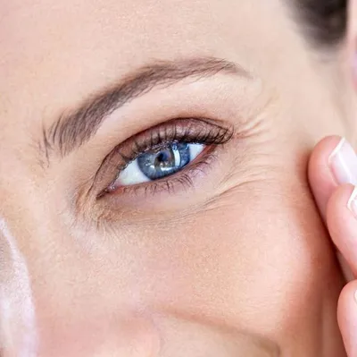 Средства от морщин вокруг глаз: рейтинг 6 самых лучших средств для разных  возрастов