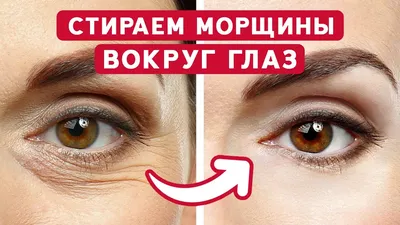 Как убрать морщины вокруг глаз: причины появления, домашние и  косметологические средства и процедуры от морщин