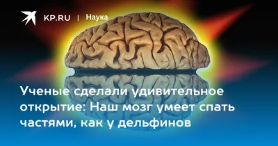 Ученые сделали удивительное открытие: Наш мозг умеет спать частями, как у  дельфинов - KP.RU