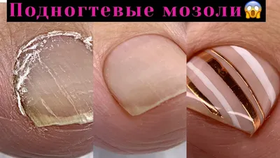 Как убрать подногтевые мозоли💅Секреты чистого педикюра😍Педикюр за 1,5  часа - YouTube