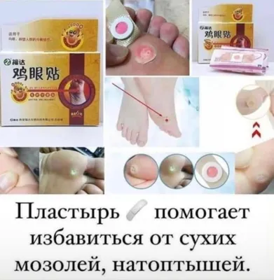 Крем для ног Floresan Кератолитический, Organic foot care - «Мозоли,  натоптыши, трещины. Говорят, должен помогать крем от Floresan. Стоит  недорого, работает неспеца. Надо ли бежать за ним в магазин?» | отзывы