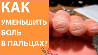 Болит мазоль большого пальца правой руки при игре на акустике -  guitar.technique - Форум гитаристов