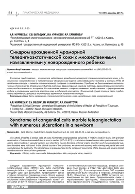 Кожа стала мраморного цвета, видны сосуды. А состояние - будто пришелец ест  тебя изнутри»: белоруска о том, как болела коронавирусом без страховки в  Москве - KP.RU