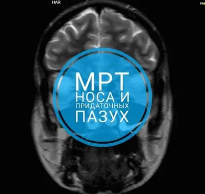МРТ Мукачево ВМТ - МРТ придаточных пазух носа - лучшей диагностики нет.  Поэтому подумайте хорошо, когда Вам назначают рентген придаточных пазух носа  | Facebook