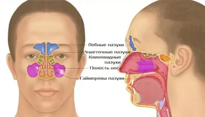Рак носа: симптомы опухоли носа и гайморовой пазухи | Онкология носовой  полости