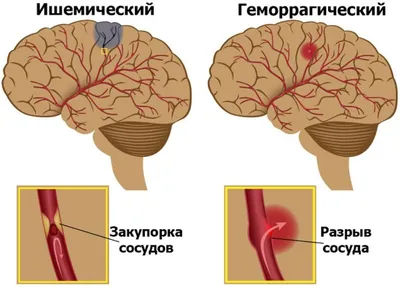 Пошаговый протокол описания анатомии околоносовых пазух перед  функциональной эндоскопической хирургией околоносовых пазух (FESS) по  данным конусно-лучевой компьютерной томографии