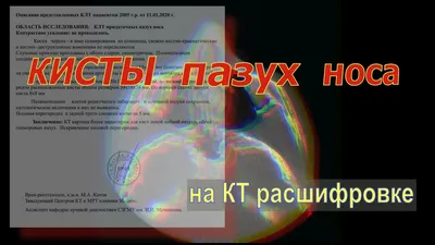 КТ пазух носа в Краснодаре - цены, отзывы, показания, как происходит  исследование | Клиника «УРО-ПРО»