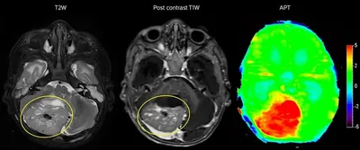 Магнитно-резонансная томография - методы и исследования МРТ