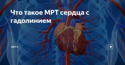 Mri сердце или Mri сердца магнитно-резонансная томография сердца в  сагитальном представлении с поперечным сечением левого и правог Стоковое  Изображение - изображение насчитывающей микстура, радиология: 220775687