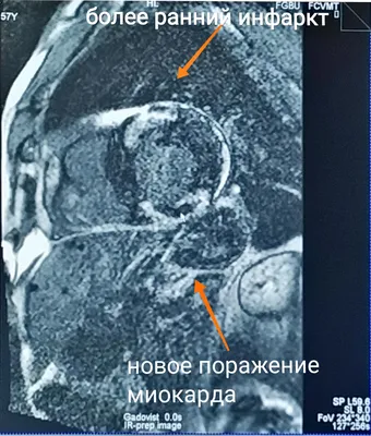 МРТ сердца в Москве – цена, сделать магнитно-резонансную томографию сердца,  адрес и запись на прием в «СМ-Клиника»