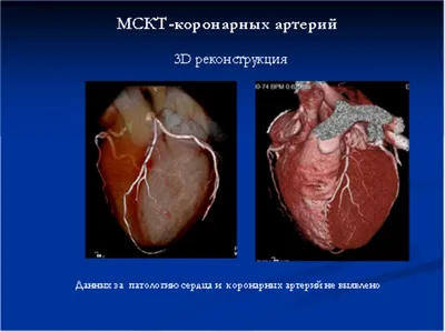 Магнитно-резонансная томография — Институт Сердца | Heart Center