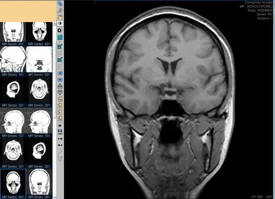 МРТ сердца и сосудов - сделать магнитно резонансную томографию сосудов  головы с контрастом и без, адреса и цены в Москве | центр Медскан