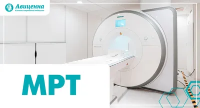 Что показывает МРТ головного мозга при эпилепсии