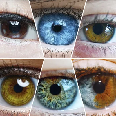 Распознать слабоумие и другие болезни по глазам - почему это реально - BBC  News Русская служба