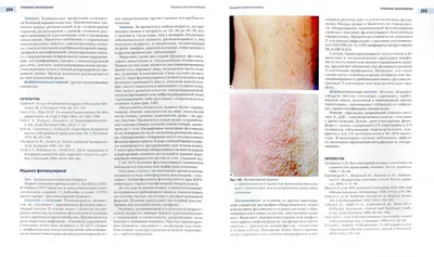 Муцинозы кожи. Склеромикседема Арндта—Готтрона - Кузнецова - Российский  журнал кожных и венерических болезней