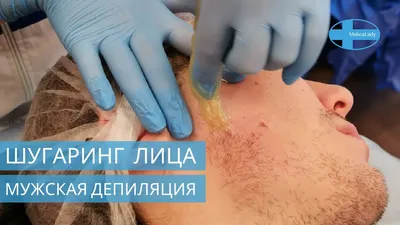 Эпиляция для мужчин в Ереване