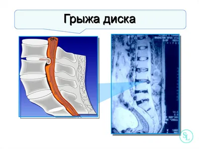 Мышца большой аддуктор - Insertiones musculi - vet-Anatomy - IMAIOS