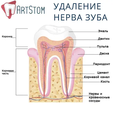 Наверное, многим из нас знакома процедура удаления нерва зуба. 😬 Первые  ассоциации – мышьяк и невыносимая боль в течение нескольк… | Odontología,  Dental, Anatomía