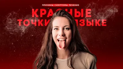 Что означает красное пятно на языке у ребенка?» — Яндекс Кью